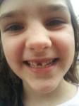 Maggie's front tooth